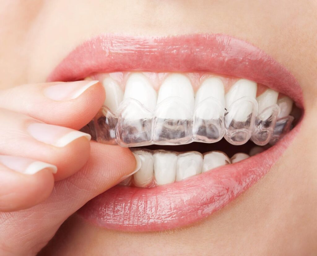 Your Dream Smile Is More Affordable