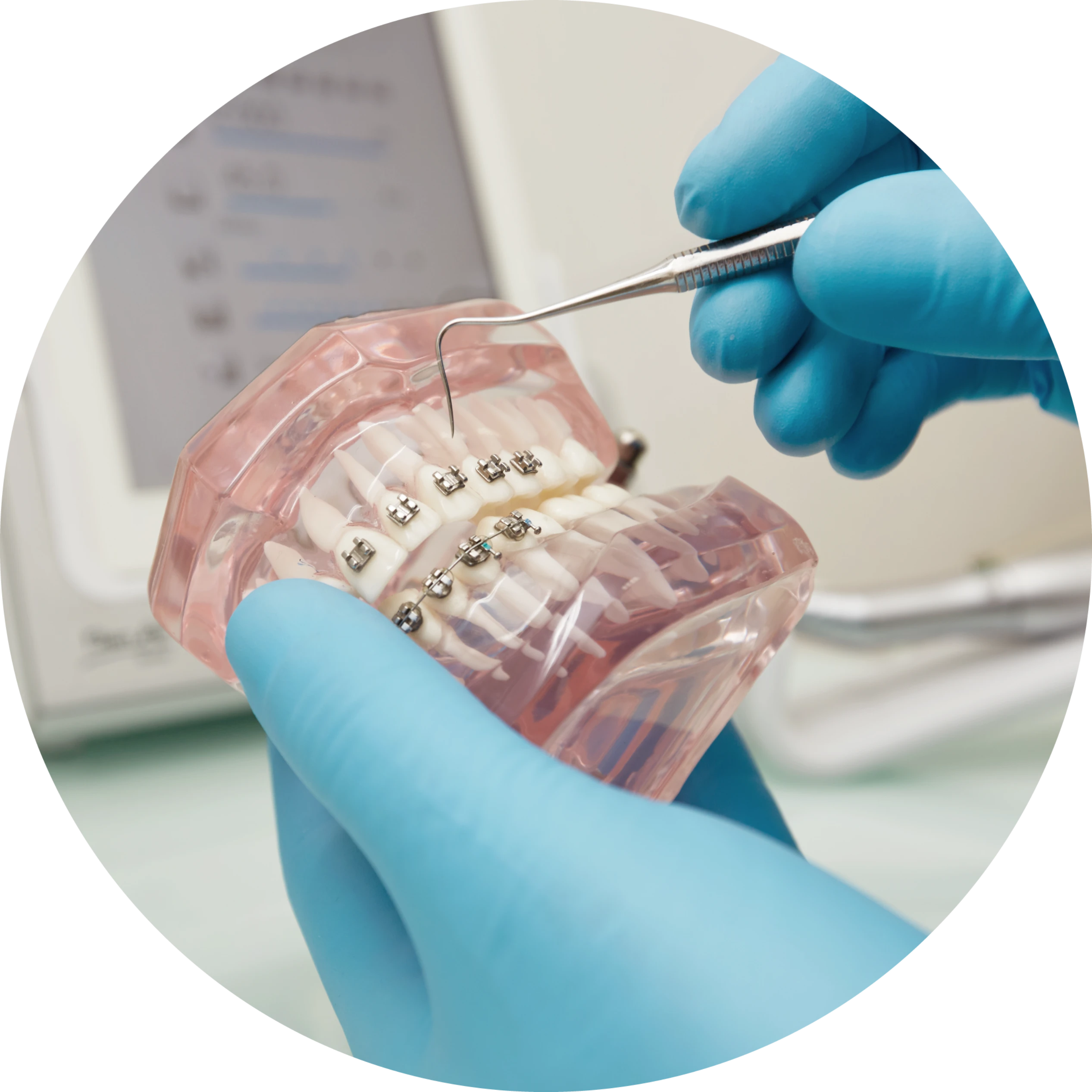 Clear Braces in Boston